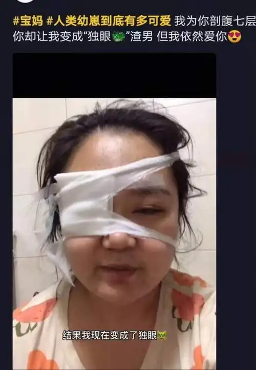 为你剖腹七层,你把我戳"独眼"却依然爱你,宝宝手敏感期咋引导