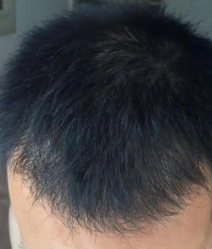 头发的密度相当的好,原生发衔接也特别自然