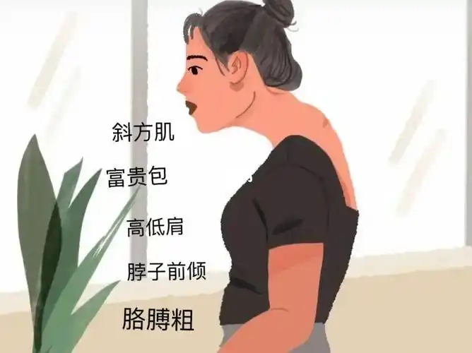 脖子前倾虎背熊腰富贵包还有救吗