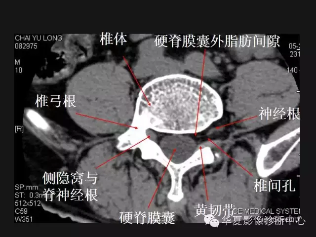 腰椎在哪里腰椎12345节的位置图