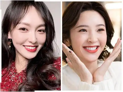 69这些笑容好看的美人,都有一个特点,那就是明眸皓齿,特别是牙齿