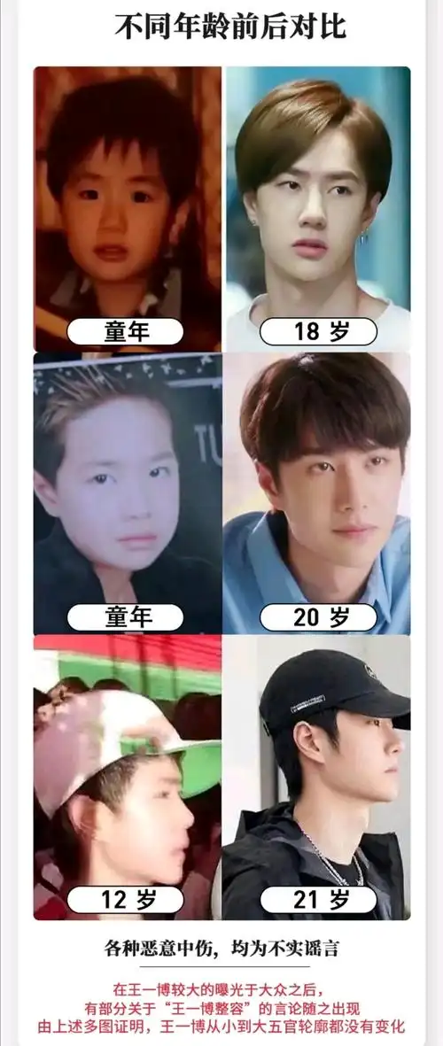 【王一博】整容谣言全面澄清,造谣可耻!