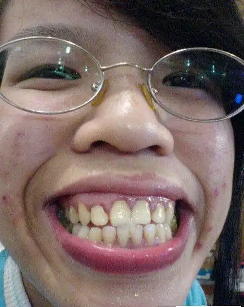 丑到你想吐!网络丑女排行榜top20 凤姐名列第六