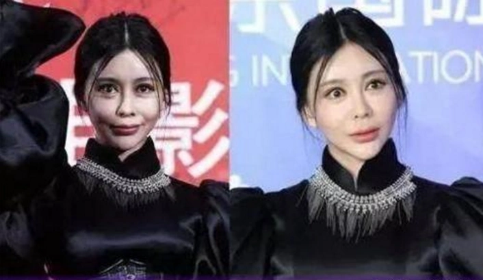 5位"整容失败"惨不忍睹的女明星,网友跪求尚雯婕收手专心音乐