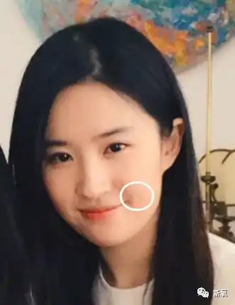 后来梨涡慢慢的开始被拉下来了,成了一个小长条.