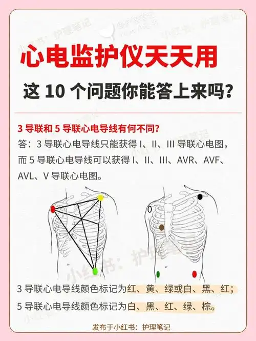 心电监护仪经常用,这些问题你能答上来吗