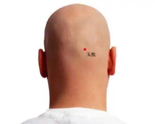 穴位的故事135玉枕:脱发