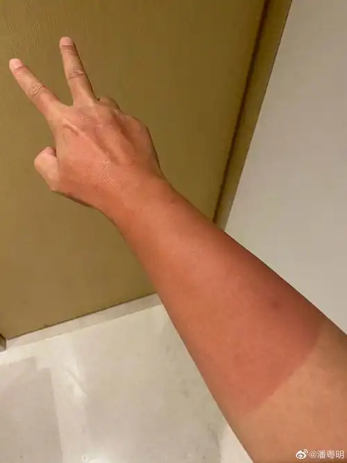 潘粤明晒被晒黑的手臂,白加黑很酷噢~多问一句……_高清图集_新浪网