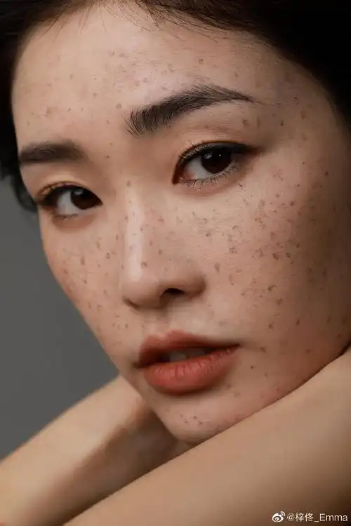 龙和雀斑公主##小雀斑妆##雀斑女生有多好看