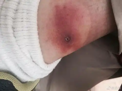 非洲蜘蛛真的会咬人的!就是不听话……"并配以