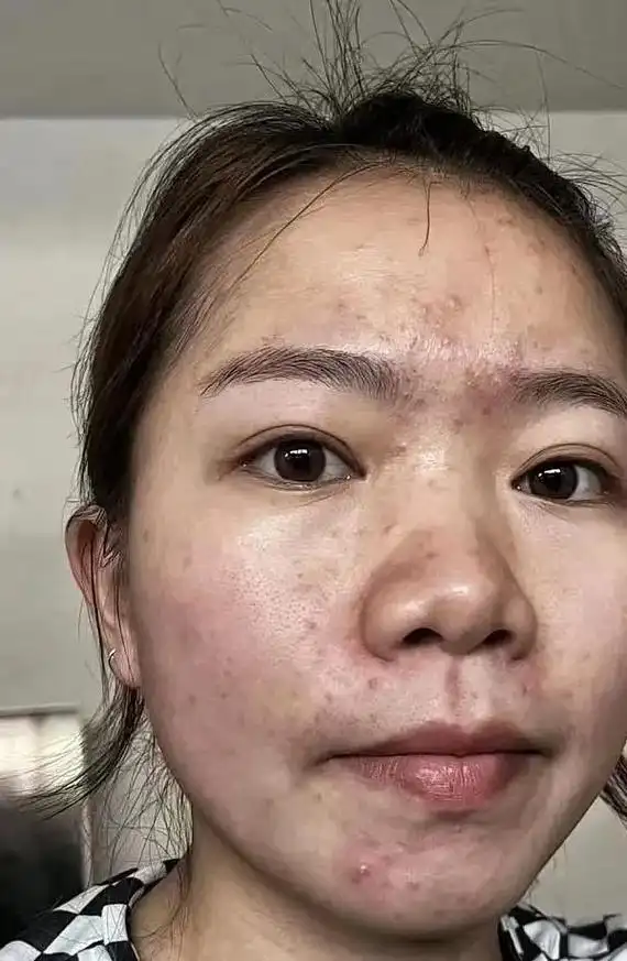 人的心态很重要,有个好的皮肤也很重要,只要脸上没