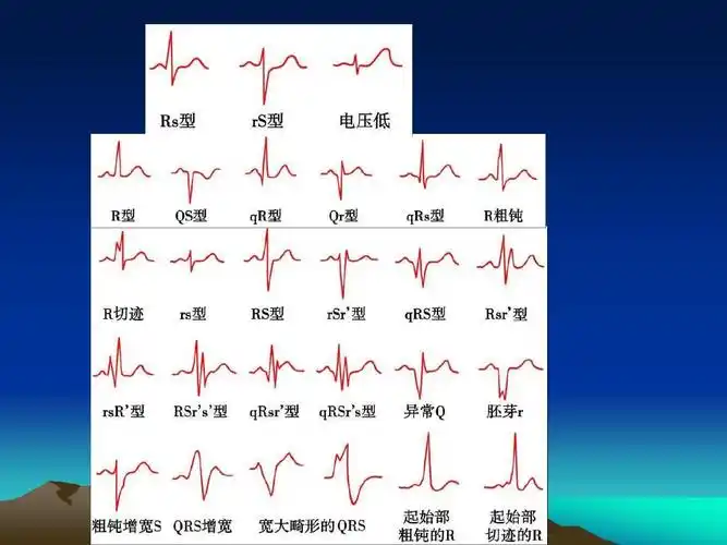 心电图的基本知识ppt