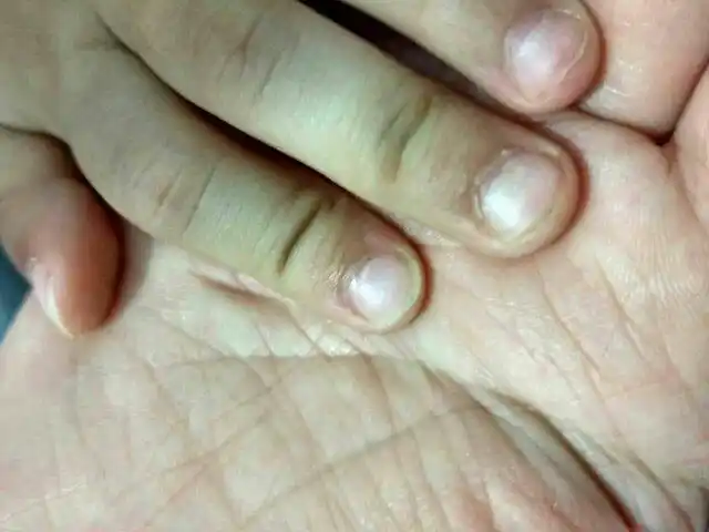小公主,不到3周岁,今天刚发现,她左手指甲有些分层了,感觉能剥开一样