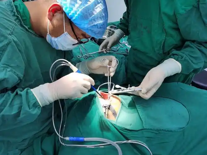 凤阳县中医院成功开展低温等离子扁桃体腺样体切除术