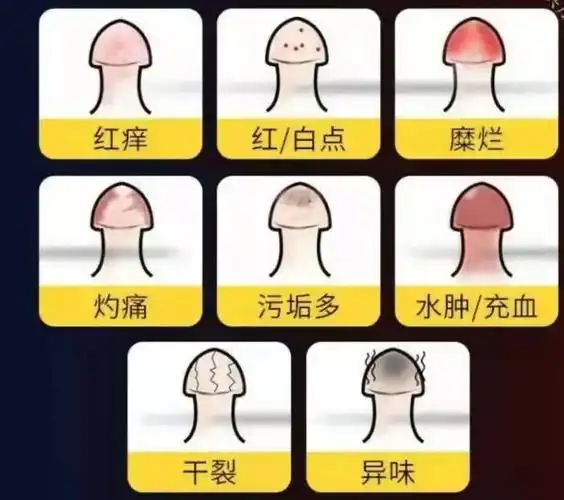 "丁头"发"炎"怎么办?—氦氖激光照射治疗为您排忧解"男"