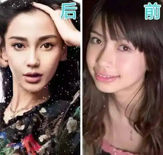 明星做整容对比照盘点一下哪些明星整过容