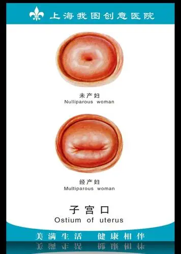 psd医院展板子宫口