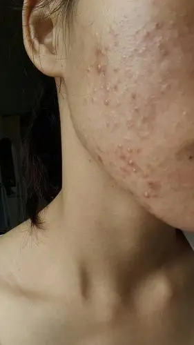 这脸绝了 哪位大神帮帮我