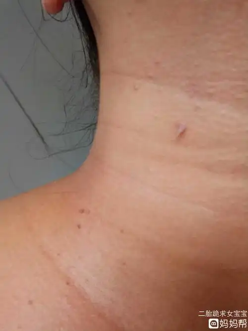 腋窝洗不干净怎么办 腋窝总是洗不干净图片