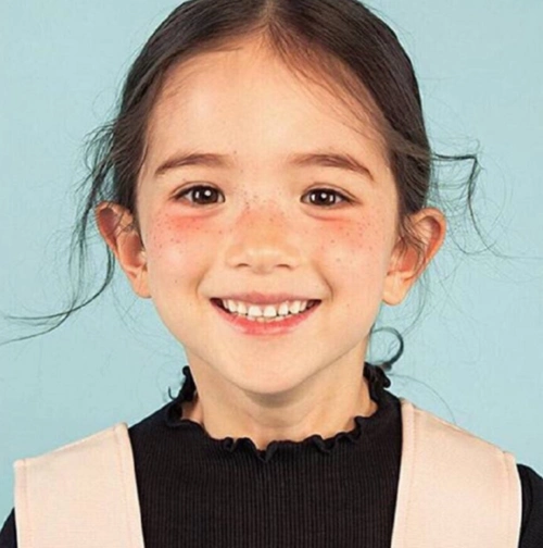 1/14 好喜欢这个雀斑小萝莉 你肯定用过她当头像!