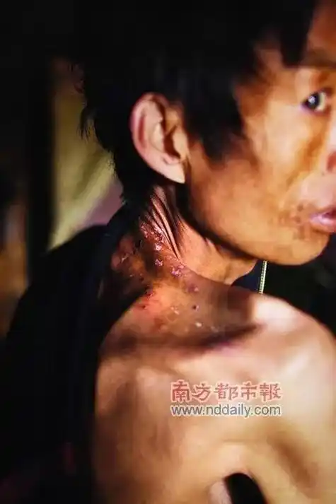 不幸感染了艾滋病毒最多能活多久