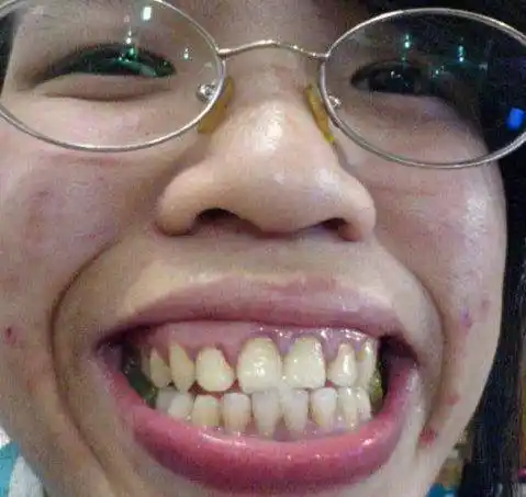 世界最丑女人大全,有图有真相!胆小勿看!