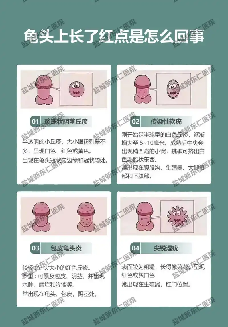 盐城男科# #盐城新东仁男科# #盐城龟头长红点# #盐城龟头上长了红点