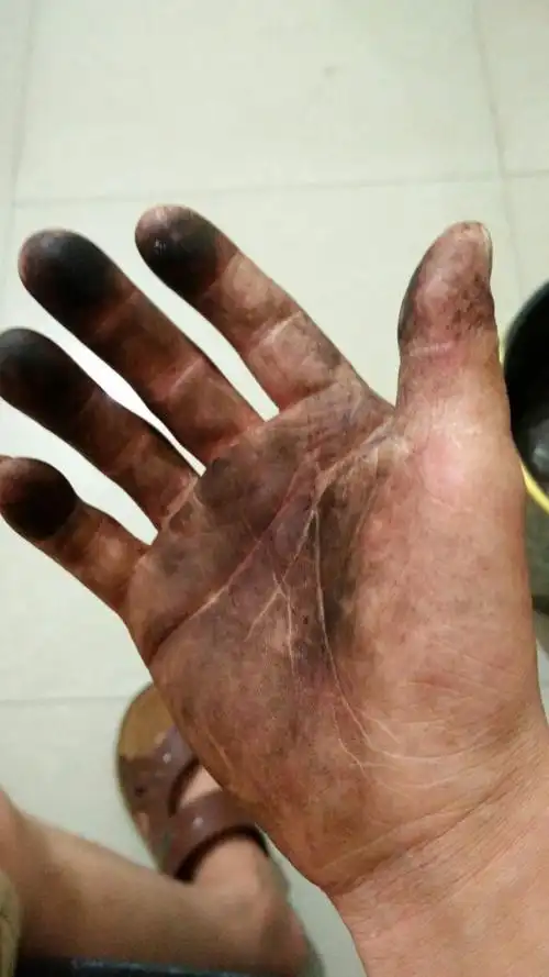 手好黑洗不掉怎么办有什么办法可以洗的掉,求解