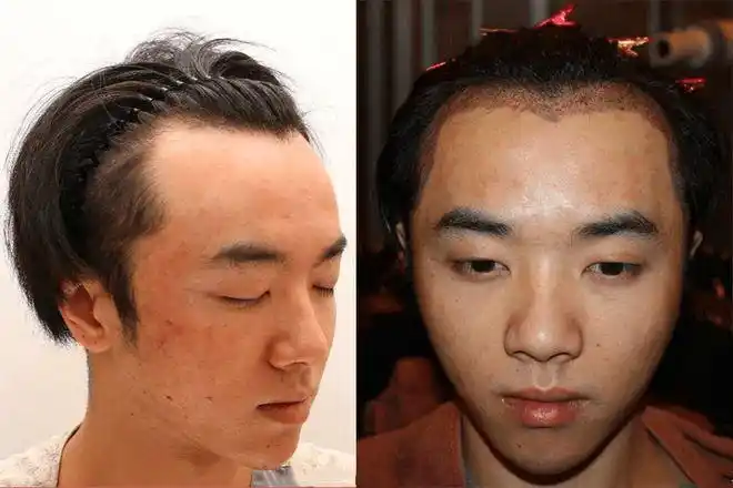 31岁华晨宇被造谣植发整容削骨如何回应张碧晨邓紫棋情感曝光