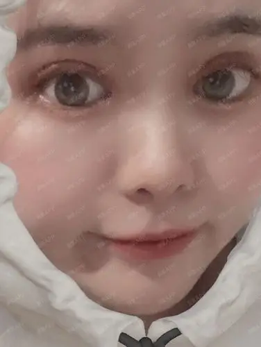 眼皮手术已经有20天了,眼睛恢复的越来越自然,怎么看都喜欢,现在照片