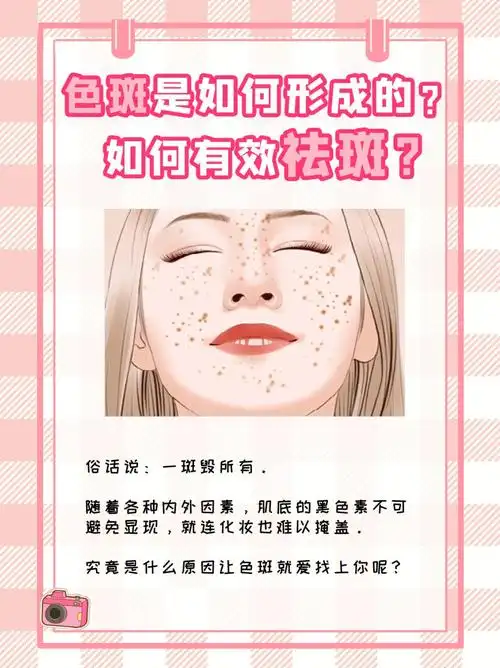 色斑是如何形成的71如何有效祛斑71