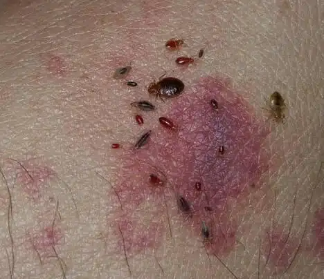 这是什么虫子 床上发现一个,壳很硬 捏一次没死