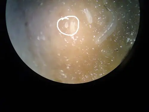 急求,谢谢!(旁边的是果蝇幼虫)