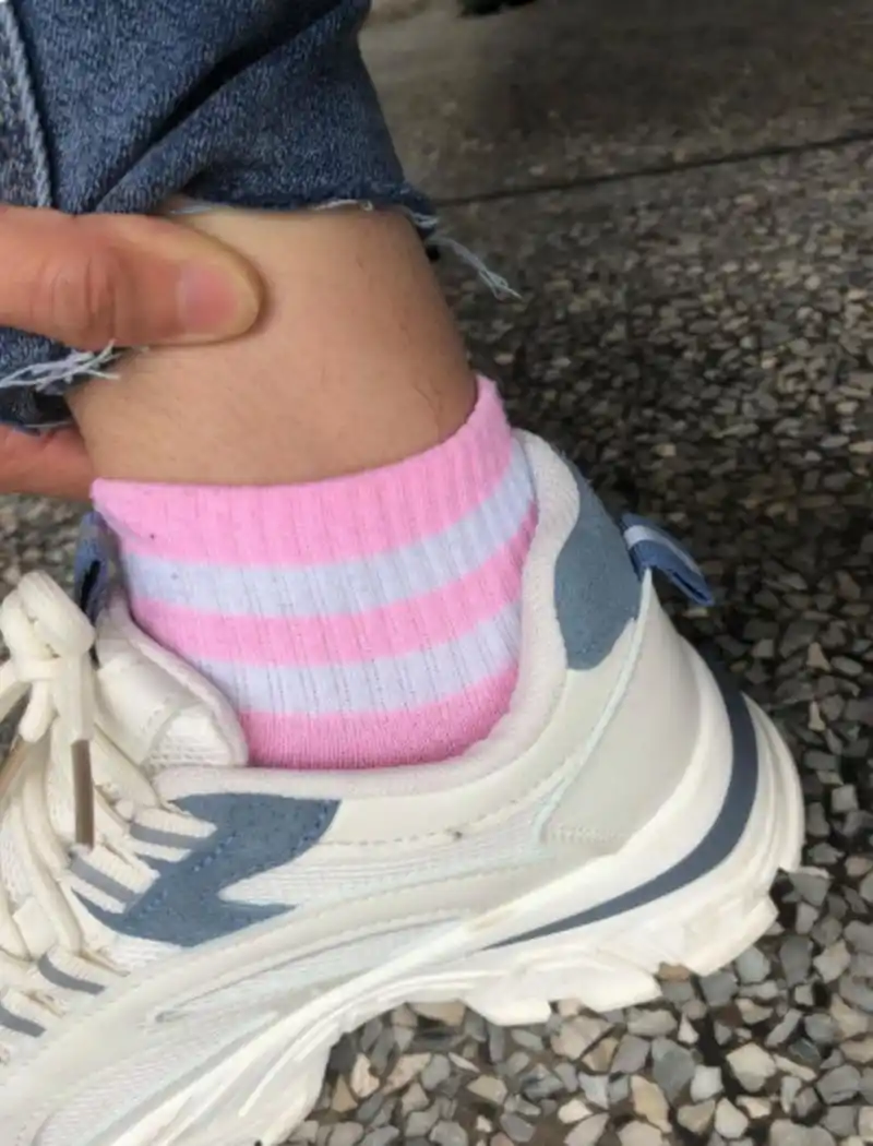 女孩子腿毛这么长,正常吗?[抠鼻]