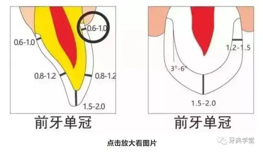 牙医学堂牙体预备操作参考