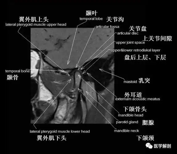 颞下颌关节的解剖,内附mr图谱