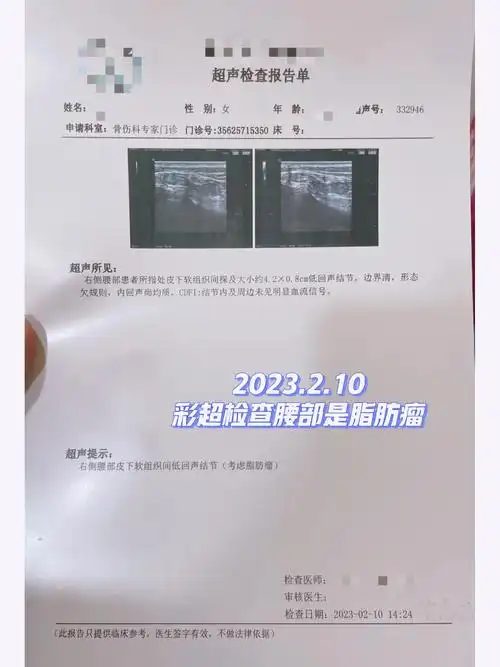 脂肪瘤切除手术01