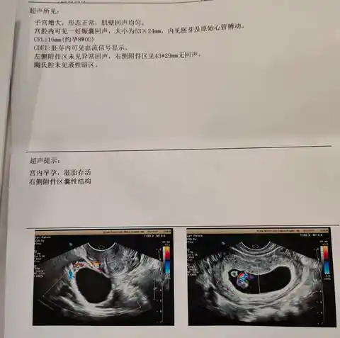 育儿问答 怀孕期 8周b超图,这图怎么看?宝宝在哪?