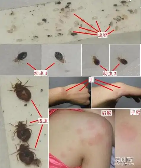 被不明虫子咬了红肿痒 虫子咬人伤口辨认图片