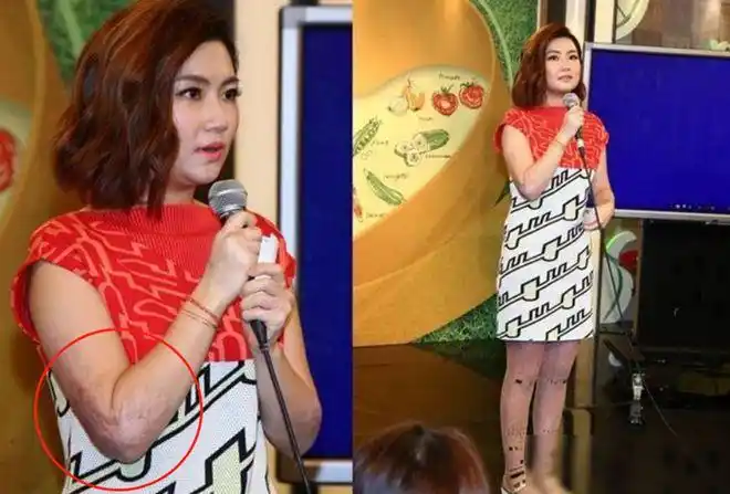 娶了毁容的selina暖男离婚后声称看她大腿真的想吐