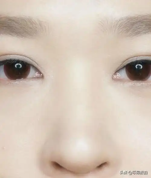 鼻子很塌怎么拯救(女孩鼻梁发育黄金时间)