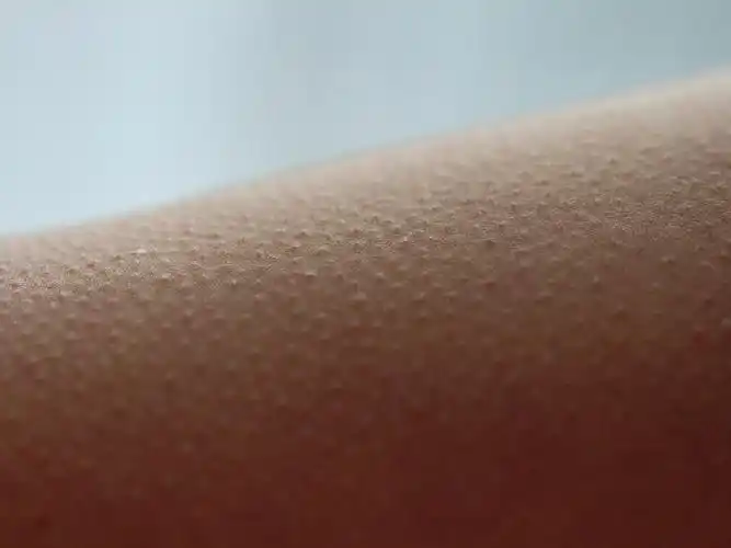 哈佛大学的一项研究探讨了我们为什么会起鸡皮疙瘩