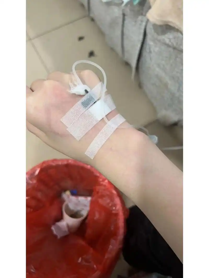 输液血管都是红的