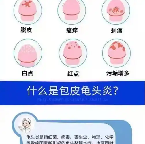 男性私处护理男龟头炎霉菌性包皮炎裂口真菌感染喷剂阴囊潮湿瘙痒 五