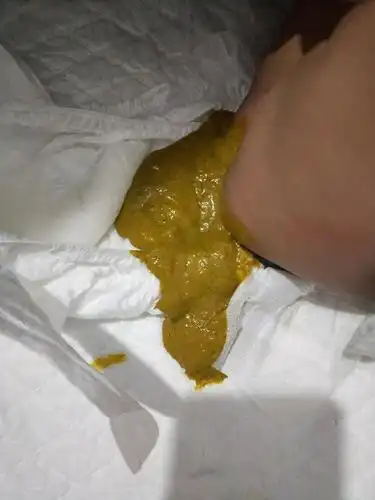 11楼 我女儿35天,这几天也是,四天拉一次,三天拉一次,这样的大便正常