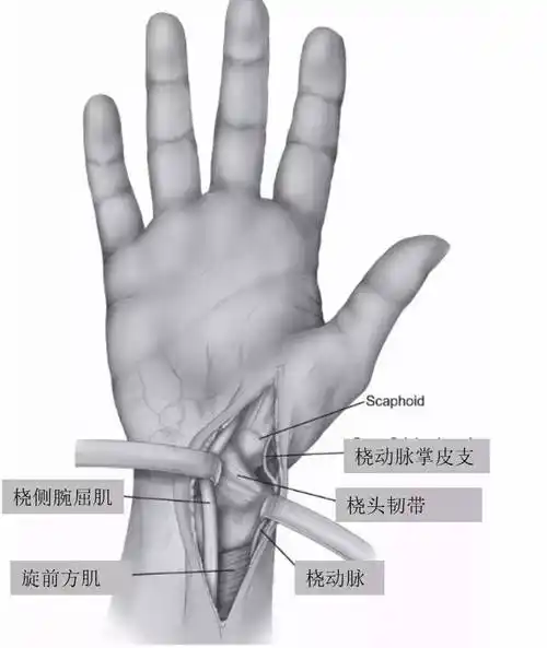 隐匿发现骨不连发生率12%---jorthop sci 2006近侧血供—骨内供应