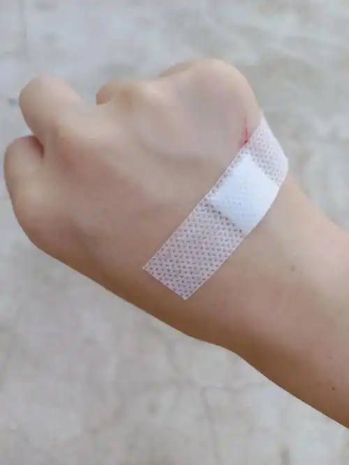 感冒挂点滴  爸爸帮我拔针 好给我划了.做饭时手不小心进到油锅里 .