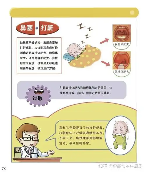 首大石萍:腺样体肥大的治疗和康复办法