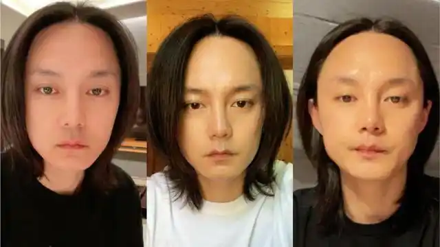 天天减肥的尹正到底为什么会肿成这样?