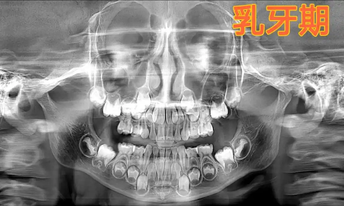 牙齿为什么要拍片子